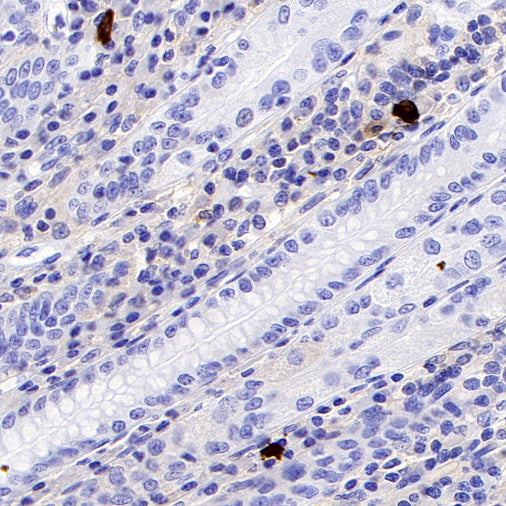 Human IgG4 Recombinant Rabbit mAb (S-1140-53)