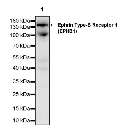 Ephrin Type-B Receptor 1 (EPHB1) Recombinant Rabbit mAb (S-4151-65)