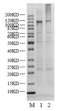 USP20 Protein