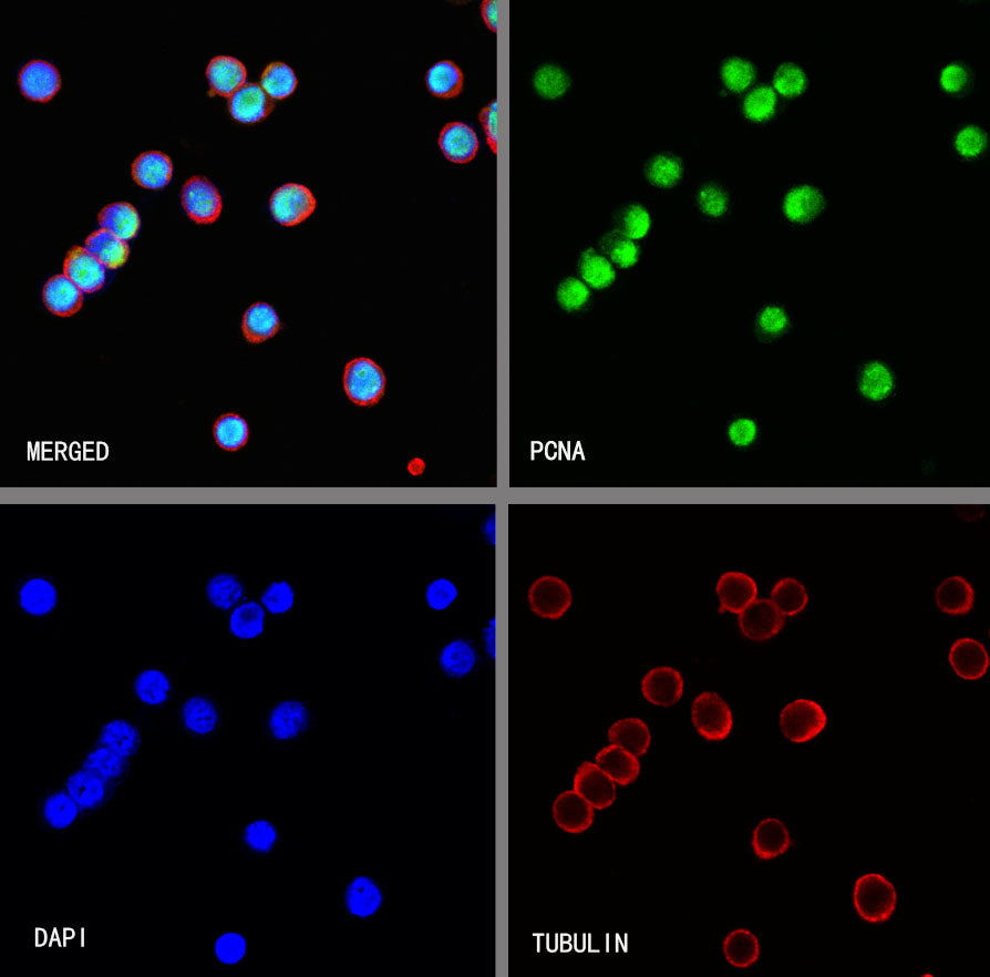 PCNA Recombinant Rabbit mAb (S-5313)