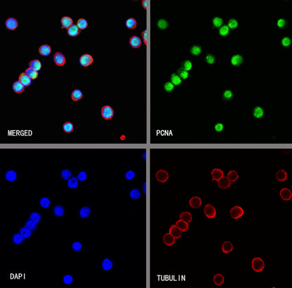 PCNA Recombinant Rabbit mAb (S-5313)