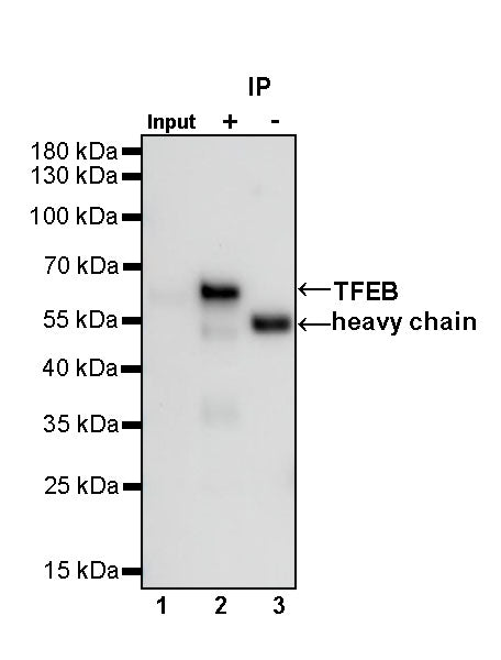 TFEB Recombinant Rabbit mAb (S-R296)