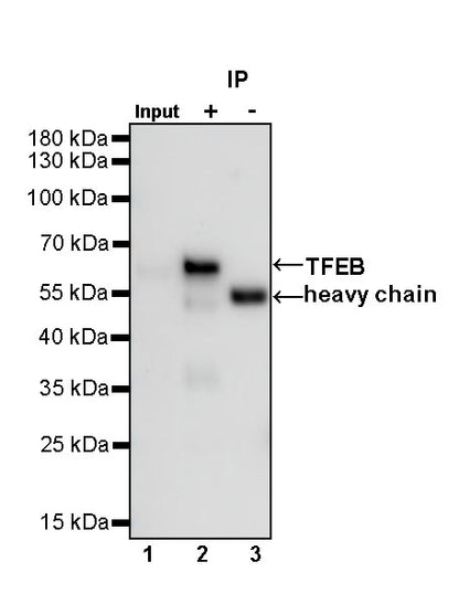 TFEB Recombinant Rabbit mAb (S-R296)