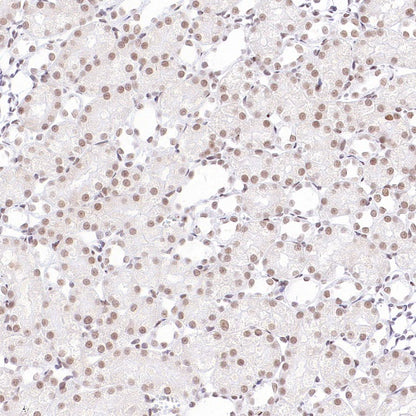 EHMT2/G9A Recombinant Rabbit mAb (S-4200)