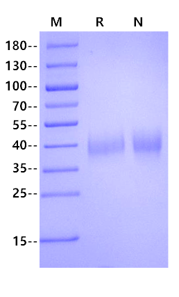 EPCR/PROCR His Tag Protein, Human