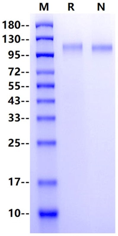 VEGF-R1/Flt-1 His Tag Protein, Human