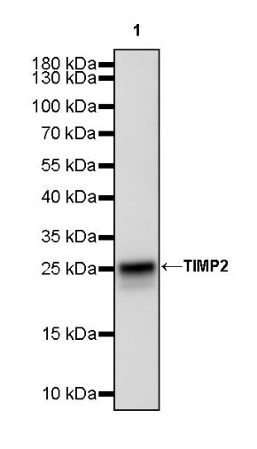 TIMP2 Recombinant Rabbit mAb (S-3369-4)