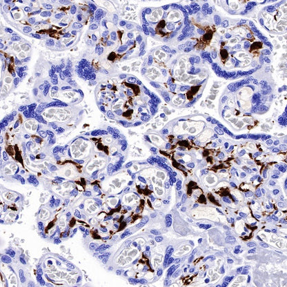 Factor XIIIa Recombinant Rabbit mAb (SDT-644-7)