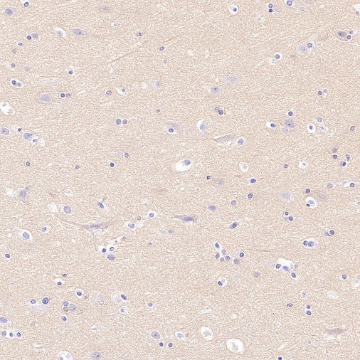 PDE4 Recombinant Rabbit mAb (S-2598-147)