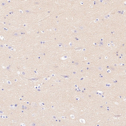 PDE4 Recombinant Rabbit mAb (S-2598-147)
