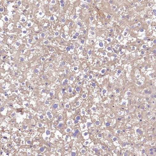 TYK2 Recombinant Rabbit mAb (S-2740-165)