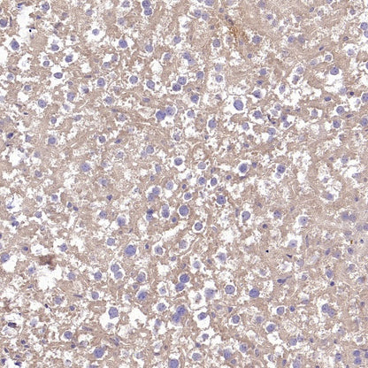 TYK2 Recombinant Rabbit mAb (S-2740-165)