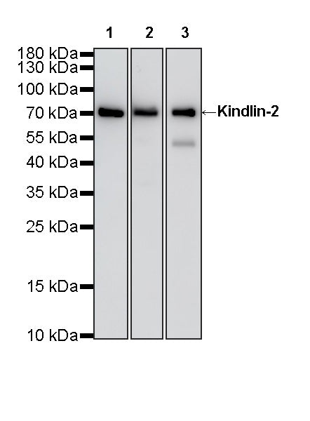 Kindlin-2 Recombinant Rabbit mAb (S-4572-66)