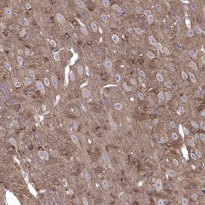 GAD65 Recombinant Rabbit mAb (S-2318-47)