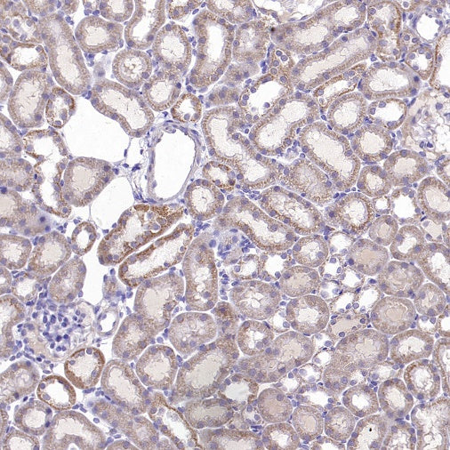 GRP75 Rabbit Polyclonal Antibody