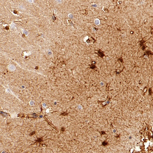 BAG3 Recombinant Rabbit mAb (S-1837-22)
