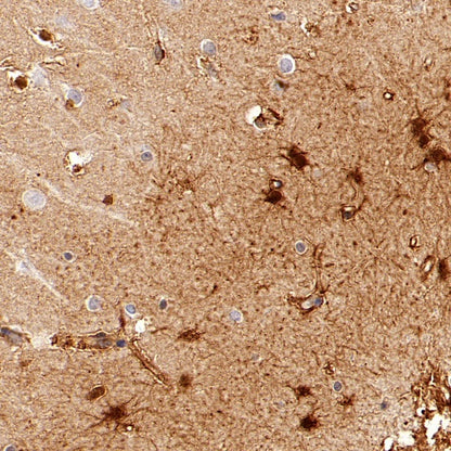 BAG3 Recombinant Rabbit mAb (S-1837-22)