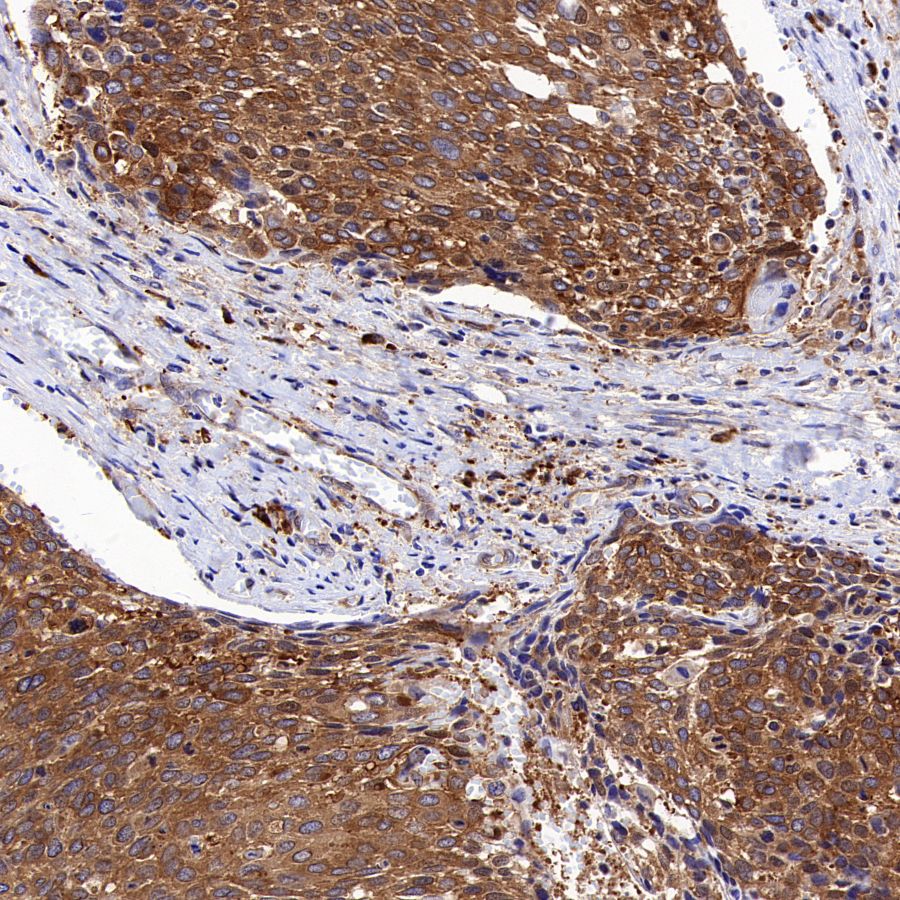 eEF2 Recombinant Rabbit mAb (S-1976-35)