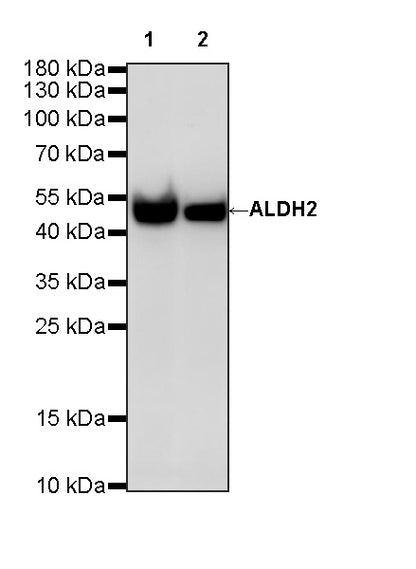 ALDH2 Recombinant Rabbit mAb (S-4173-20)