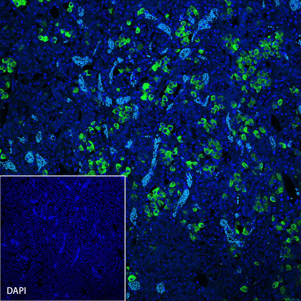 ACTH Recombinant Rabbit mAb (SDT-363-60)