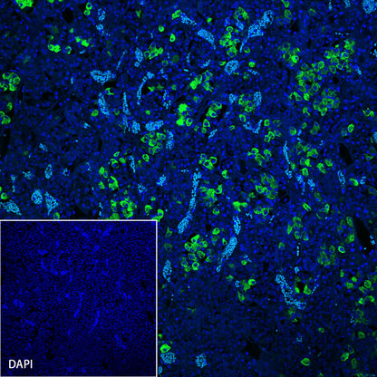ACTH Recombinant Rabbit mAb (SDT-363-60)