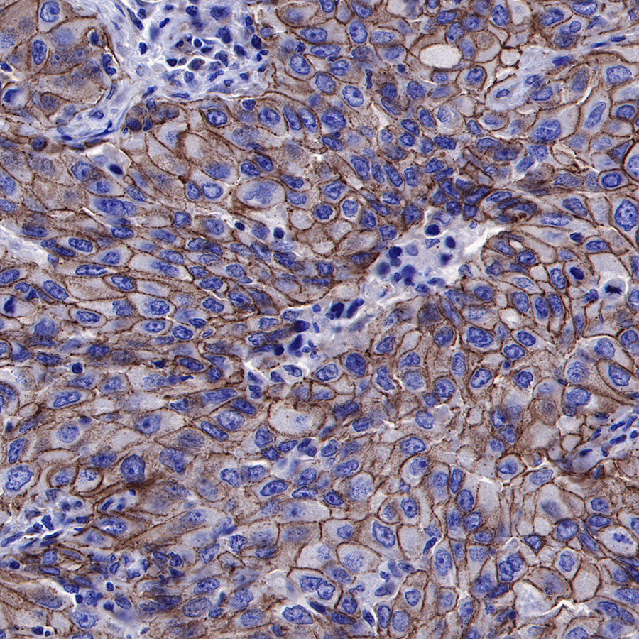 β-Catenin Recombinant Rabbit mAb,PBS Only (SDT-336-23)