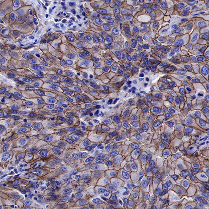 β-Catenin Recombinant Rabbit mAb,PBS Only (SDT-336-23)