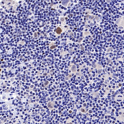 c-Myc Recombinant Rabbit mAb (S-519-54)