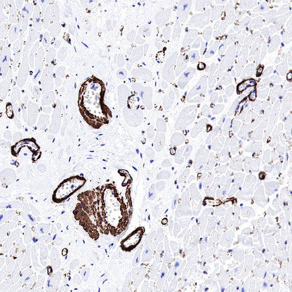 alpha smooth muscle Actin (SMA) Recombinant Rabbit mAb,PBS Only (SDT-132-63)