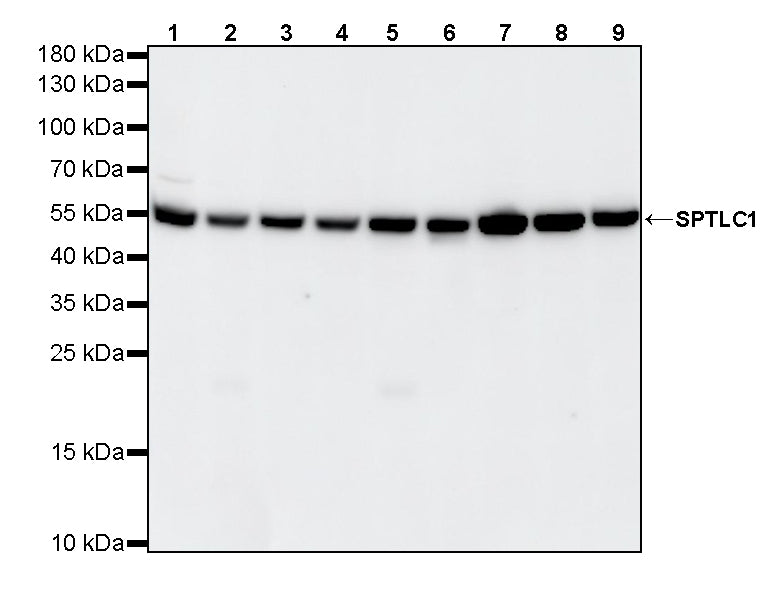SPTLC1 Recombinant Rabbit mAb (S-6028)