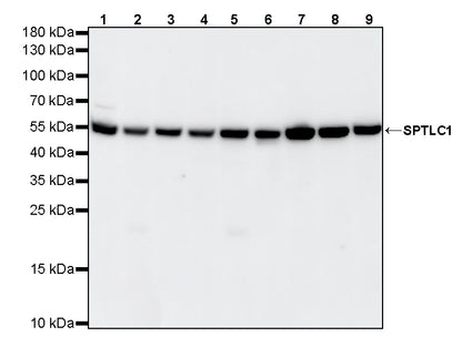 SPTLC1 Recombinant Rabbit mAb (S-6028)