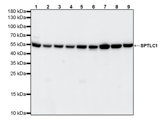 SPTLC1 Recombinant Rabbit mAb (S-6028)