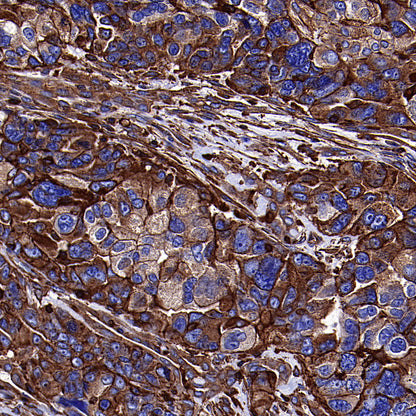 β-Actin Recombinant Rabbit mAb (S-5701)