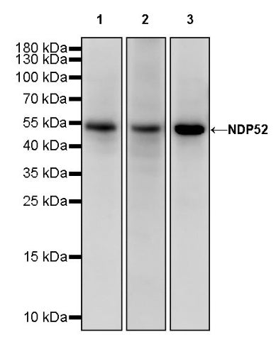 NDP52 Rabbit Polyclonal Antibody