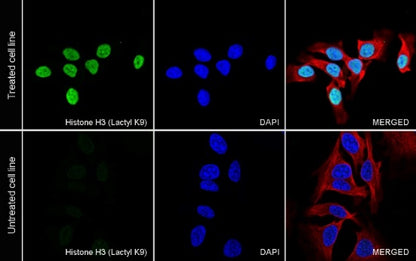 Histone H3 (Lactyl K9) Recombinant Rabbit mAb (S-R397)