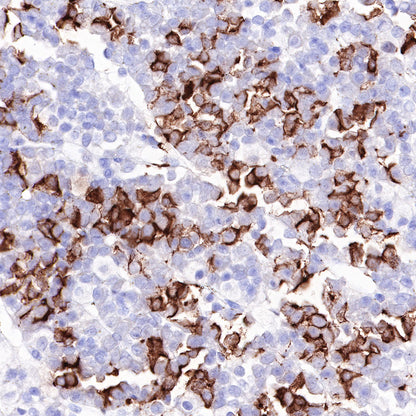 ACTH Recombinant Rabbit mAb (SDT-363-60)