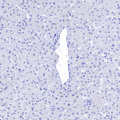 CDH17 Recombinant Rabbit mAb (SDT-3276-83)