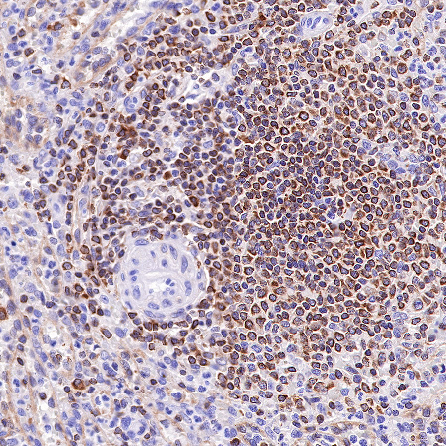 S-RMab® Bcl-2 Recombinant Rabbit mAb,PBS Only (SDT-R160)