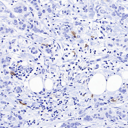 CLEC9A Recombinant Rabbit mAb (S-1904-154)