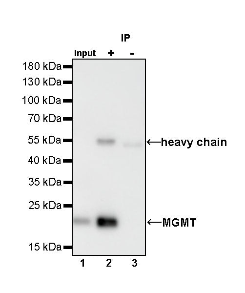 MGMT Recombinant Rabbit mAb,PBS Only (SDT-522-71)