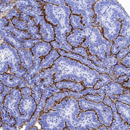 NaPi2b/SLC34A2 Recombinant Rabbit mAb, PBS Only (SDT-1771-79)