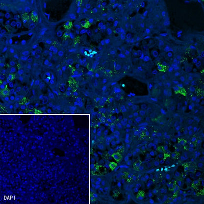 TSHB Recombinant Rabbit mAb (S-537-52)