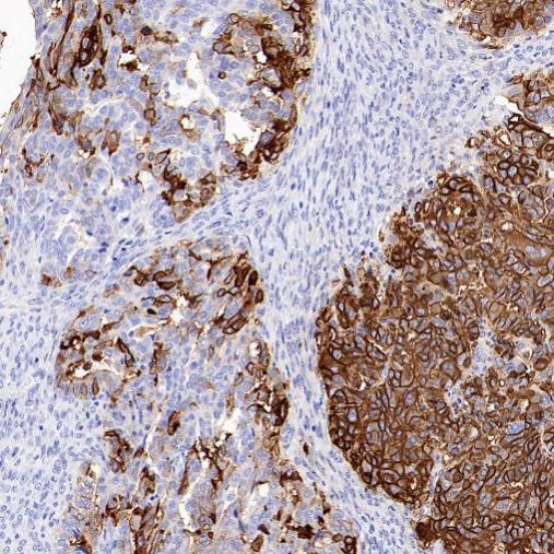 ALPP/ALPPL2 Recombinant Rabbit mAb (S-2089-36)