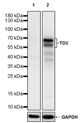 TOX Recombinant Rabbit mAb (S-2296-44)