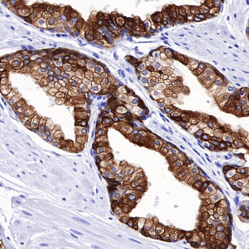 CK8/18 Recombinant Rabbit mAb (SDT-P005)