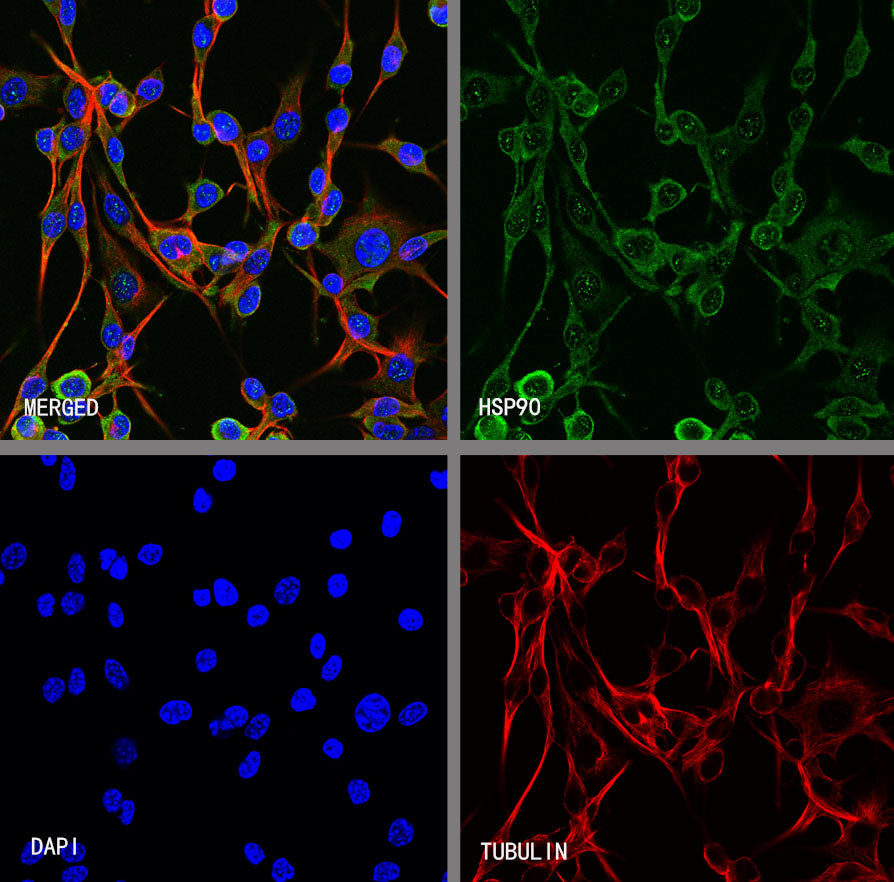 HSP90 Recombinant Rabbit mAb (S-5412)