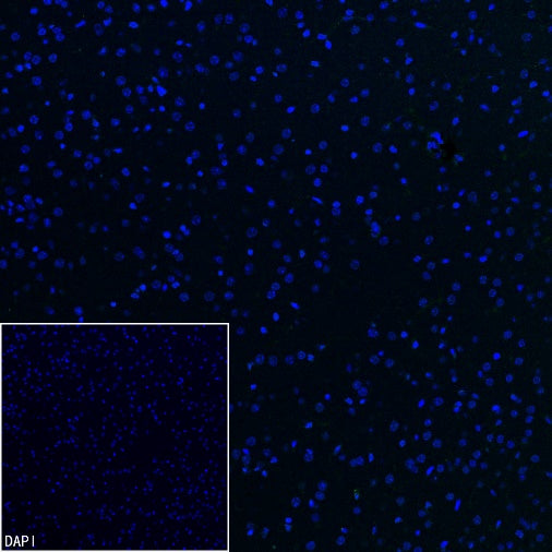 Lipocalin-2/NGAL Recombinant Rabbit mAb (S-2280-129)