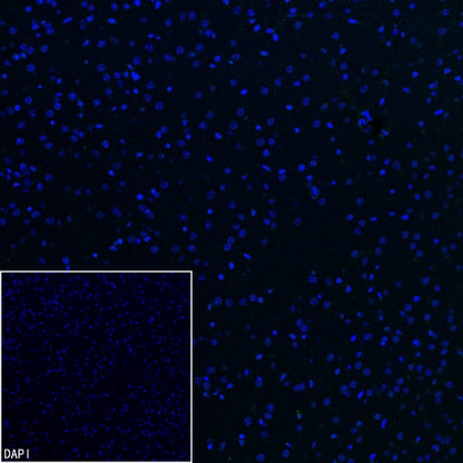 Lipocalin-2/NGAL Recombinant Rabbit mAb (S-2280-129)