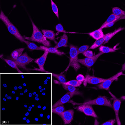 GAPDH Recombinant Rabbit mAb (Alexa Fluor® 647 Conjugate) (S-4718)
