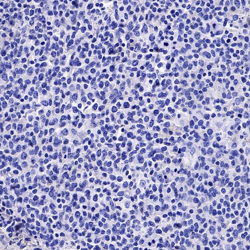 5T4 Recombinant Rabbit mAb (S-R361)